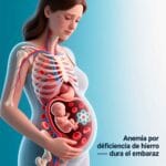 Anemia en embarazadas en Ocoa